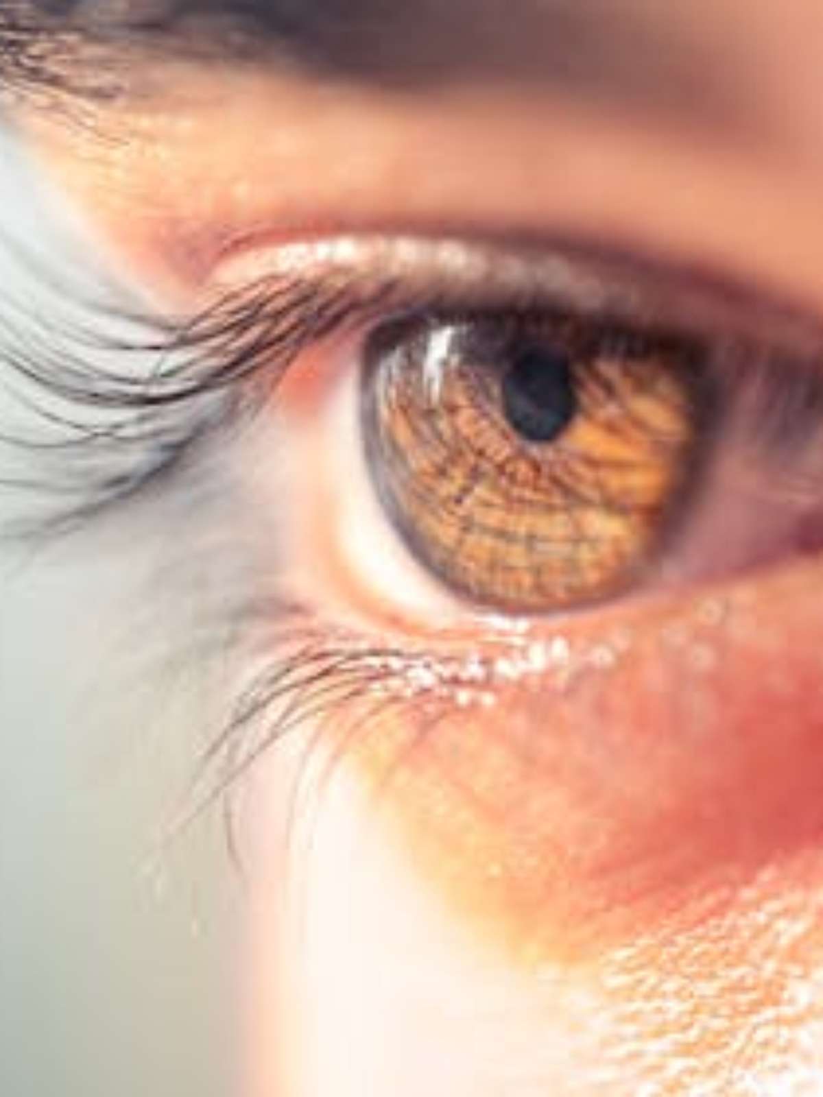 Os homens estão raspando os cílios no TikTok. Saiba por que isso pode ser uma má ideia