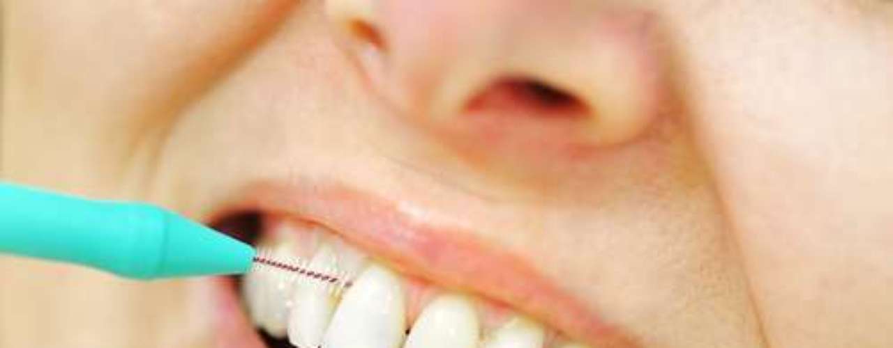 Passo 6 - Já tem escova interdental? Apenas as escovas interdentais alcançam completamente concavidades e irregularidades entre os dentes. Insira a ponta da escova interdental entre dois dentes de forma inclinada em direção a gengiva. Nos dentes superiores inclina-se a escova um pouco para cima e nos dentes inferiores inclina-se a escova um pouco para baixo. Lembre-se de fazer isso delicadamente. Se a escova deslizar muito facilmente, sem qualquer pressão, opte por uma de diâmetro maior. Não é necessário fazer movimentos de vai e vem, apenas coloque e retire a escova e a limpeza já estará feita. Mas lembre-se de usa-la diariamente.