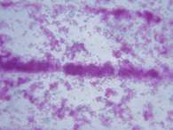 Es posible que la vitamina C llegue a usarse junto con fármacos contra la tuberculosis. Foto: Thinksotck