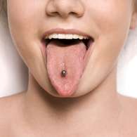 Piercing oral: una moda que perjudica la salud bucal. Foto: Shutterstock