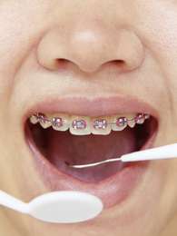 p Foto: ThinkStock