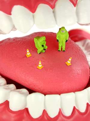 Saiba como prevenir e combater bactérias resistentes da boca