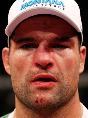 Nariz de Shogun ficou fora do lugar após o soco de Henderson Foto: Getty Images