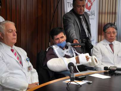Gabriel Granados Vergara, de 52 años, al centro, muestra su trasplante de brazos en conferencia de prensa en el Instituto Nacional de Ciencias Médicas y Nutrición en la Ciudad de México, el jueves 7 de junio de 2012. La operación constituye el primer trasplante de ambas extremidades en América Latina, según los especialistas. A la derecha, el doctor Martin Iglesias morales y a la izquierda el doctor Fernando Gabilondo Navarro. Granados había perdido ambos brazos debido a una descarga eléctrica.  Foto: Secretaría de Salud / AP