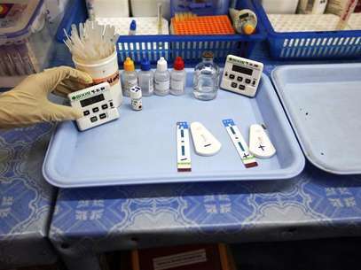 HIV tests show negative and positive results in Medecins Sans Frontieres-Holland (AZG)'s clinic in Yangon February 21, 2012. Foto: Soe Zeya Tun / Reuters In English