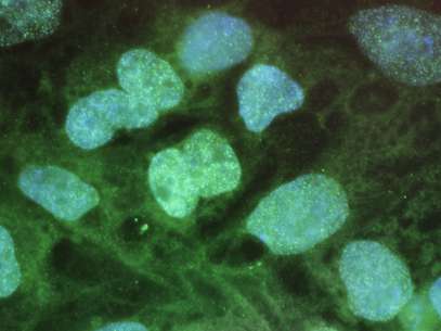 Células-tronco são vistas em tela de computador Foto: Getty Images