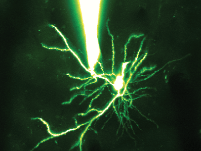 Imagem mostra um dendrito, uma estrutura em forma de galho do neurônio. O objeto no topo é uma pepita presa ao dendrito para medir a eletricidade. O brilho no centro da imagem é um pico de eletricidade que ocorre quando essa estrutura processa informação Foto: Spencer Smith / Divulgação