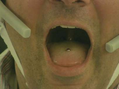O piercing do tamanho de um feijão produz um campo magnético que muda quando a língua se movimenta Foto: Reprodução / BBCBrasil.com