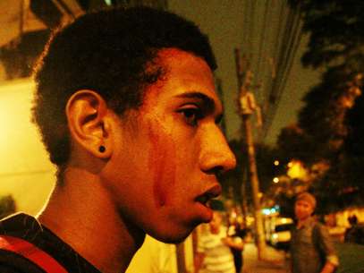 No trajeto, ainda na rua Vergueiro, depois de uma correria, alguns manifestantes foram agredidos. Foi o caso do estudante Guilherme Caetano de Souza, 20 anos, que acabou com um corte na cabeça.  Foto: Vagner Magalhães / Terra