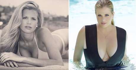 Danielle modelando antes e depois de vencer a anorexia 