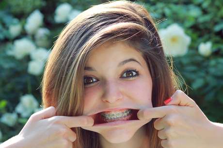 Uma pesquisa feita em Portugal revelou que 20% dos adolescentes não escovam os dentes diariamente 