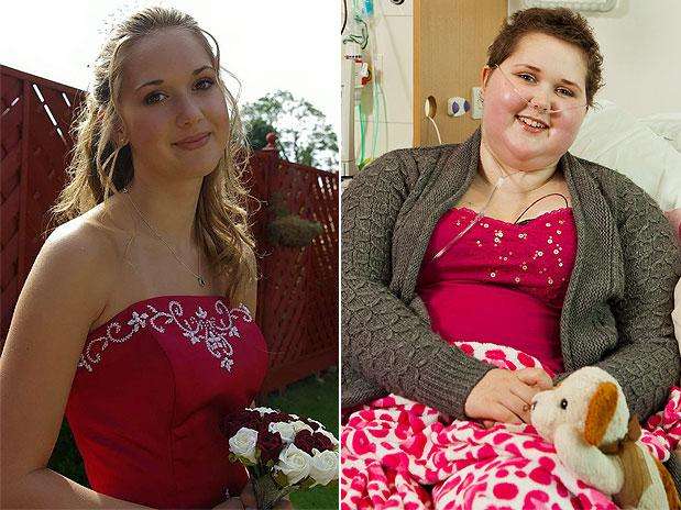 Stephanie Knight antes del descubrimiento del cáncer (izquierda) y después en el tratamiento. Foto:  / BBC en español
