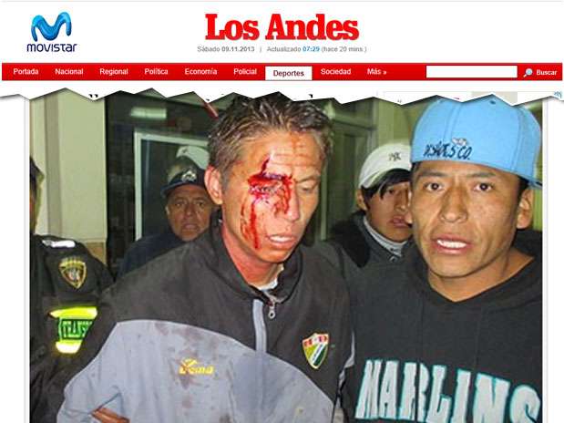 Jogador Martín Dall'orso ficou com o rosto desfigurado após agressões Foto: Los Andes / Reprodução