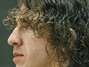 Puyol, operado de nuevo Foto: Agencia EFE / Getty Images
