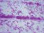 Es posible que la vitamina C llegue a usarse junto con fármacos contra la tuberculosis.Foto: Thinksotck