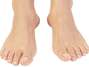 El lugar preferidos de los hongos para colonizar son los pies.Foto: Thinksotck
