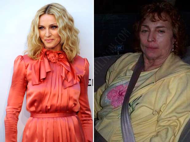 Madonna - Estas celebridades tienen todo el potencial para ser bellos pero la página en facebook Planet Hiltron ha encontrado la manera de bajarlos de su pedestal y revelar su identidad si no fueran famosos, sin los millones para tratamientos, estilistas ni la disciplina del ejercicio y la buena alimentación. ¿Cuál es tu transformación favorita? Foto: Getty Images/Planet Hiltron