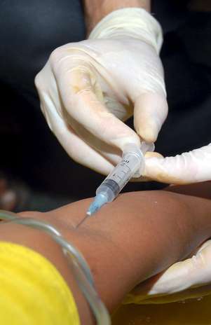 La mielofibrosis es rara, siendo diagnosticada un 0.5 por cada 100 mil personas cada año Foto: EFE en español La mielofibrosis es rara, siendo diagnosticada un 0.5 por cada 100 mil personas cada año Foto: EFE en español