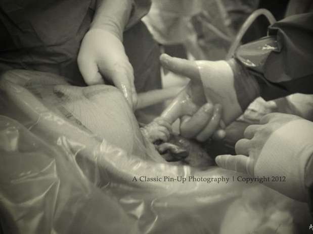 La foto en la que se observa el nacimento de una bebé quien al momento de salir del vientre de su madre toma del dedo al doctor que la trajo al mundo se convirtió en la primera imagen viral del año. Foto: Tomada de Twitter La foto en la que se observa el nacimento de una bebé quien al momento de salir del vientre de su madre toma del dedo al doctor que la trajo al mundo se convirtió en la primera imagen viral del año. Foto: Tomada de Twitter
