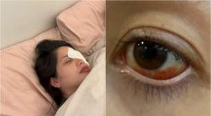 'Tive muito medo de ficar cega', disse influenciadora que sofreu hemorragia ocular