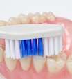 ¿Qué tipos de prótesis dentales hay?