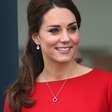 Revelan el secreto de la sonrisa de Kate Middleton