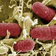 Surto de superbactérias pode matar até 80 mil britânicos