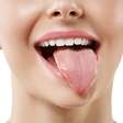 ENQUETE: Língua suja causa mau hálito e diminui o paladar?