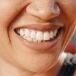 Infográfico: Por que alguns dentes são mais amarelos?