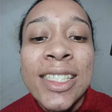 Mulher trans que teve dente quebrado por homem recupera sorriso