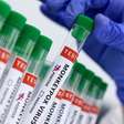 África do Sul identifica primeiro caso de varíola dos macacos
