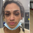 Esposa mostra ferimentos causados por agressão de astro da NBA