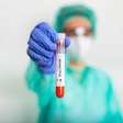 Aparecida estabelece protocolos para atendimentos de varíola de macaco