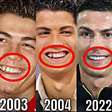 Foto de Cristiano Ronaldo usando aparelho viraliza. Veja a transformação