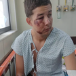 Jovem é agredido por pai e filho lutadores de MMA em bloco de carnaval