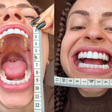 Influenciadora busca recorde de maior boca feminina no mundo