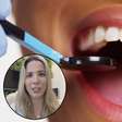 Vídeo: 5 perigos de se fazer um clareamento dental caseiro