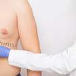 Ginecomastia: veja como famosos corrigiram condição nas mamas