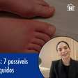 Inchaço em pernas e pés: 7 possíveis causas do acúmulo de líquidos