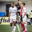 Kevyson segue fora e Santos esboça escalação para o jogo do ano