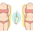 Lipoaspiração é a cirurgia plástica mais realizada no Brasil