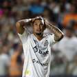 Patrocinadores vão ficar com o Santos na Série B? Veja a situação do contrato de cada um