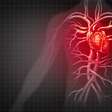 O melhor remédio para refrear as doenças cardiovasculares, segundo estudo
