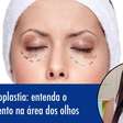 Blefaroplastia: entenda o procedimento na área dos olhos