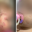 Bebê é agredida em creche e família alega omissão de socorro: 'Minha filha foi espancada'
