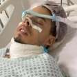 Homem vai para UTI após tirar siso em faculdade da Unesp: 'Gritava de dor'