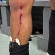 Athletico posta foto da perna de Cuello e reclama: "Nem falta?"