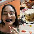 Mulher viraliza ao aparecer com sorriso preto após comer bolo; corante comestível faz mal?