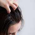 Psoríase no couro cabeludo: doença pode causar queda capilar