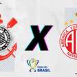 Corinthians x América-RN: prováveis escalações, desfalques, retrospecto, onde assistir, arbitragem e palpites